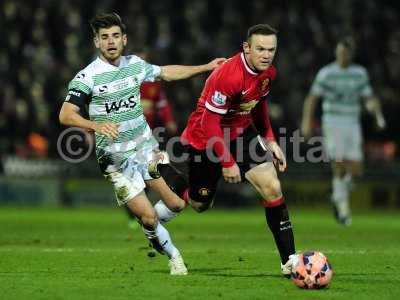 Yeovil Town v Manchester United 040115