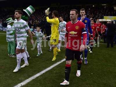 Yeovil Town v Manchester United 040115